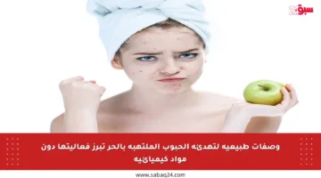 وصفات طبيعية لتهدئة الحبوب الملتهبة بالحر تبرز فعاليتها دون مواد كيميائية